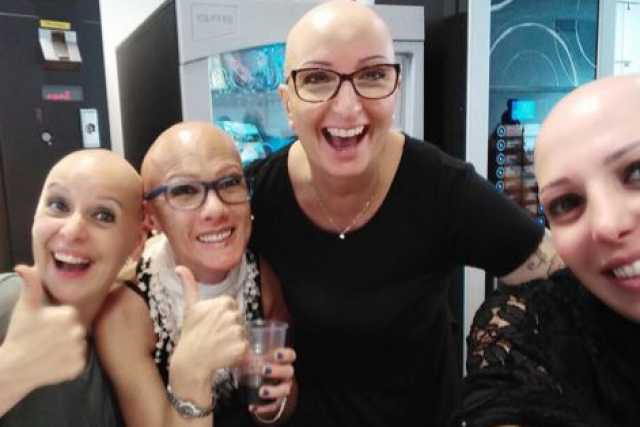 Quando si diventa calvi all'improvviso: �E' l'alopecia areata, male non riconosciuto�